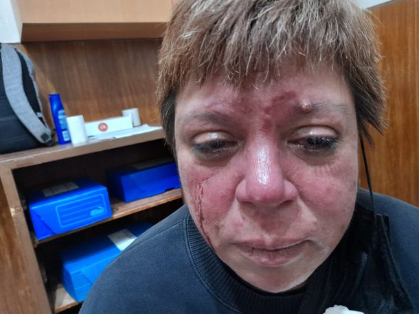 Dueños de una hamburguesería que hacían una fiesta clandestina agredieron a una inspectora