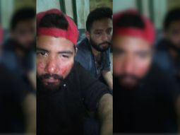 Ariel y Matías fueron agredidos brutalmente cerca de la estación de trenes de Quilmes