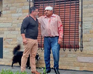 Brutal golpiza a un hombre para robarle