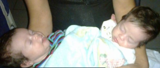 Piden ayuda para afrontar los gastos médicos de siamesas internadas