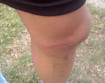 Esta brutal plancha suspendió el amistoso