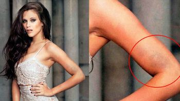 barbie velez: estaba acostumbrada a posar con moretones y siempre me los tapaban barbie velez: estaba acostumbrada a posar con moretones y siempre me los tapaban