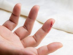 ¿Por qué duele tanto cortarse con papel?