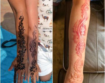 El antes y el después de Madison Gulliver