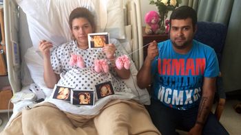 nacieron trillizas identicas y dos son siamesas nacieron trillizas identicas y dos son siamesas