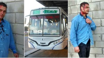 Así quedó el colectivero de la línea 620 Así quedó el colectivero de la línea 620