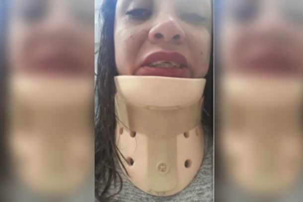 Córdoba: motochorros desfiguraron a una mujer que iba a su despedida de soltera