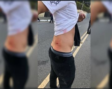 El hincha de Independiente acuchillado en la puerta del estadio