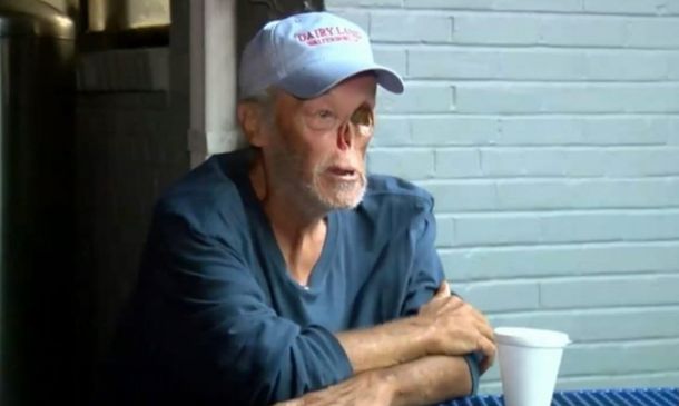 Echaron de un restaurante a un sobreviviente de cáncer porque asustaba a los clientes