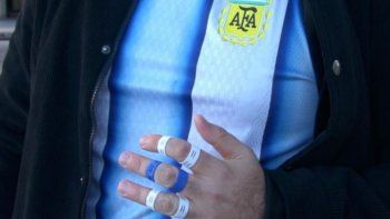 Emprendedores crearon un protector de dedos para Dibu Martínez y llegaron al Mundial 2026 Emprendedores crearon un protector de dedos para Dibu Martínez y llegaron al Mundial 2026