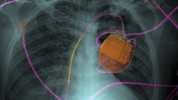 Dispositivos asesinos: la primer cybermuerte sucederá en 2014