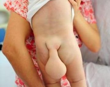 Conmoción por un bebe chino que tiene una cola de castor