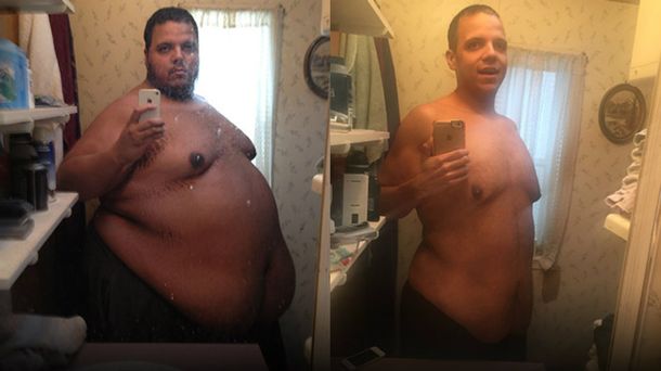 Un hombre logró bajar más de 150 kilos después de dos años de esfuerzo