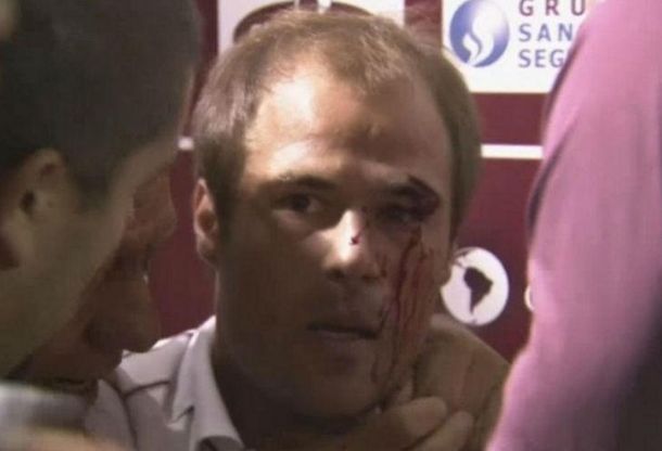 Un jugador de Lanús fue agredido por un hincha tras la derrota con Argentinos