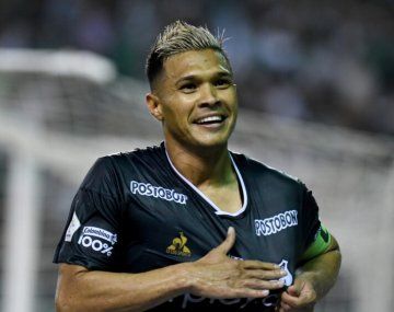 El impactante look de Teo Gutiérrez para enfrentar con Deportivo Cali a Boca
