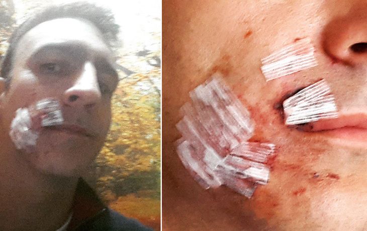 Luis Pavesio, desfigurado por un perro