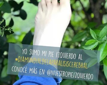 Nuestro pie izquierdo en el&nbsp;Día Mundial de la Parálisis Cerebral