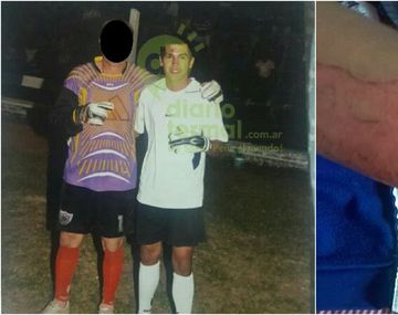 Mauricio El Torito González y el brazo herido de su pareja