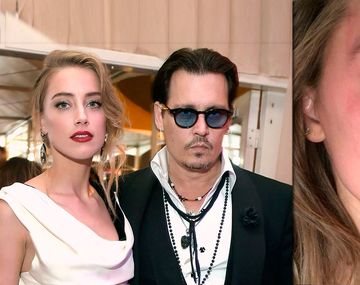 Violencia de género: la foto de su esposa golpeada que complica a Johnny Depp