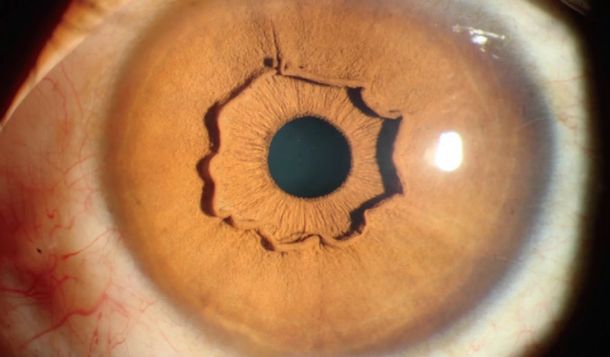 El extraño iris de una mujer china