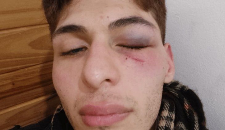 La Plata: brutal golpiza a una persona no binaria y con síndrome de Asperger