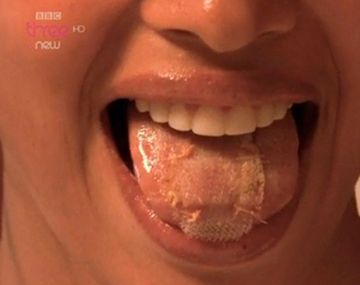 Insólito tendencia: modelos se cosen la boca para adelgazar y ganar un concurso