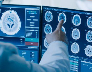 Todos por Fede: tiene 9 años y necesita un costoso tratamiento para salvar su vida