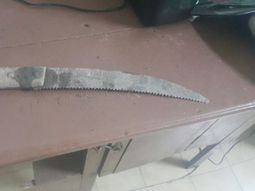 le pego a su novia, golpeo a otra mujer y le corto la oreja con un serrucho a un hombre le pego a su novia, golpeo a otra mujer y le corto la oreja con un serrucho a un hombre