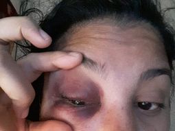 Ex mujer del jugador Mazzacote denunció violencia de género Ex mujer del jugador Mazzacote denunció violencia de género