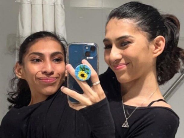 Una de las siamesas influencers presentó a su novio y contó el acuerdo que tiene con su hermana