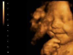 el bebe mas feliz del mundo ya sonreia en la panza de su madre el bebe mas feliz del mundo ya sonreia en la panza de su madre