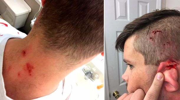 Un joven fue atacado por su gato en Navidad