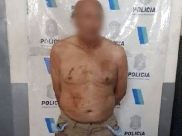 Femicidio en Loma Hermosa: un jubilado mató a su esposa y fue detenido