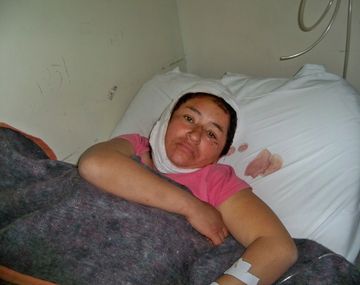 Atacó a su mujer a martillazos porque se quería separar