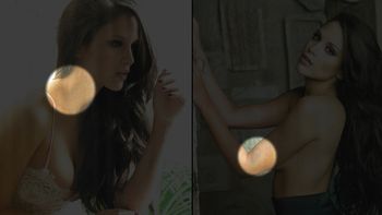 los contundentes moretones de barbie velez: borrarlos iba a ser complicidad con la violencia los contundentes moretones de barbie velez: borrarlos iba a ser complicidad con la violencia