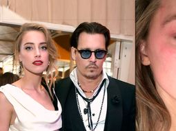 johnny depp, denunciado por haber golpeado a su esposa: la imagen que lo compromete johnny depp, denunciado por haber golpeado a su esposa: la imagen que lo compromete