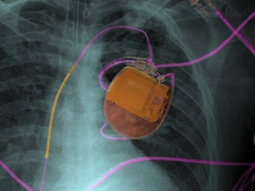 dispositivos asesinos: la primer cybermuerte sucedera en 2014 dispositivos asesinos: la primer cybermuerte sucedera en 2014
