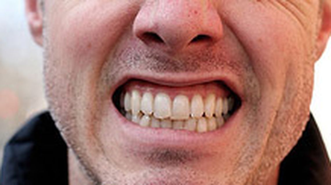 Bruxismo: El apretar o rechinar los dientes ¿qué hacer?