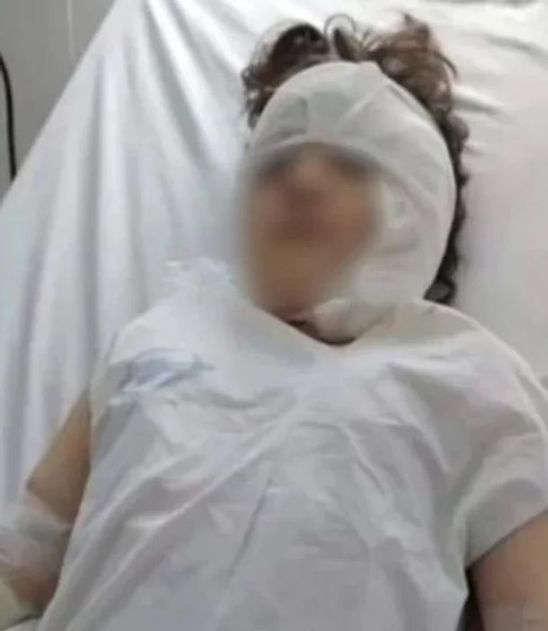 El animal le provocó heridas que le desfiguraron el rostro y fue trasladada a un hospital de Buenos Aires. El animal le provocó heridas que le desfiguraron el rostro y fue trasladada a un hospital de Buenos Aires.