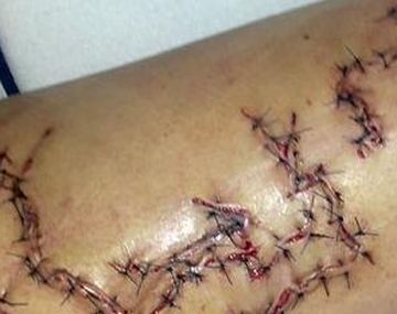 Un australiano salva a una mujer de ser devorada por un tiburón