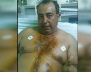 Así se recupera Adrián Pérez