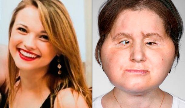 El antes y después de Katie