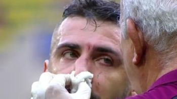 El ex delantero de Vélez podría jugar con una máscara El ex delantero de Vélez podría jugar con una máscara