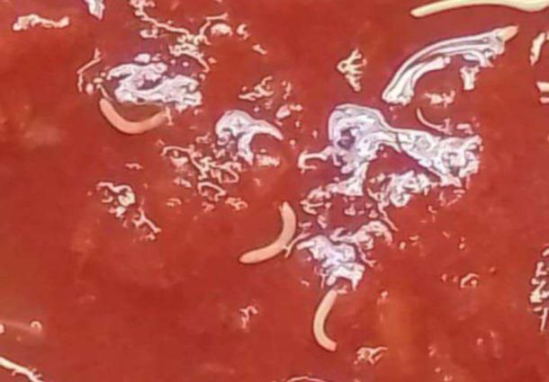 La advertencia de ANMAT por un lote de un alimento contaminado con gusanos: los detalles
