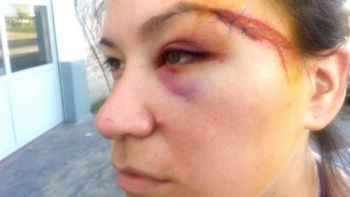 Fuente: Diario Varela al día Fuente: Diario Varela al día