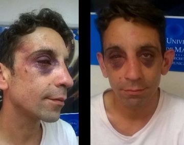 Habló el joven atacado por una patota