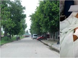 El delincuente amputado será detenido una vez que se recupere El delincuente amputado será detenido una vez que se recupere