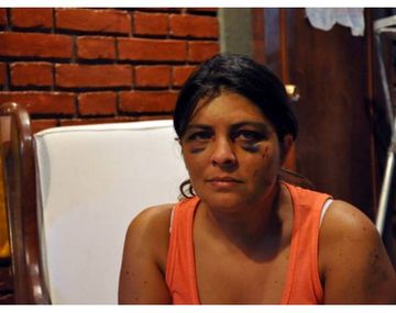 La mujer golpeada en Mendoza dijo que la quisieron matar