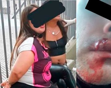 Atacaron a piedrazos e hirieron a un policía que les pidió que se colocaran los barbijos