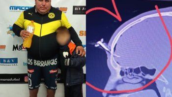 quien es el acusado de clavarle una llave en la cabeza a un jugador del ascenso quien es el acusado de clavarle una llave en la cabeza a un jugador del ascenso